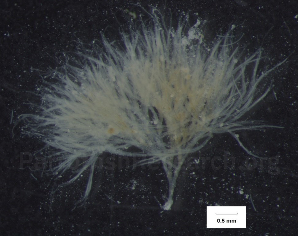 Calothrix and Dichothrix cyanobacteria under a macro lens