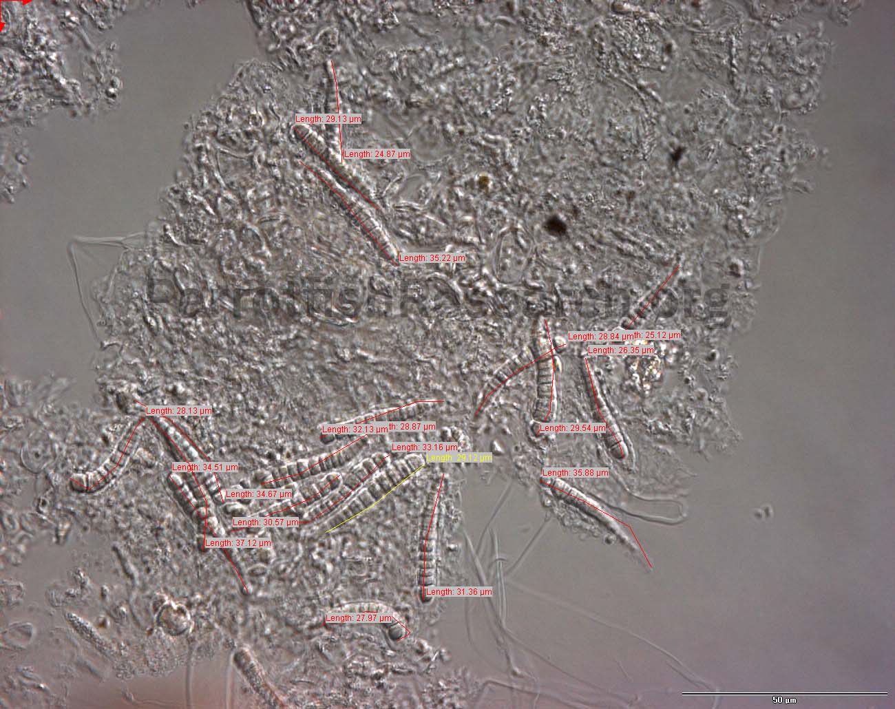 Calothrix coral reef cyanobacteria