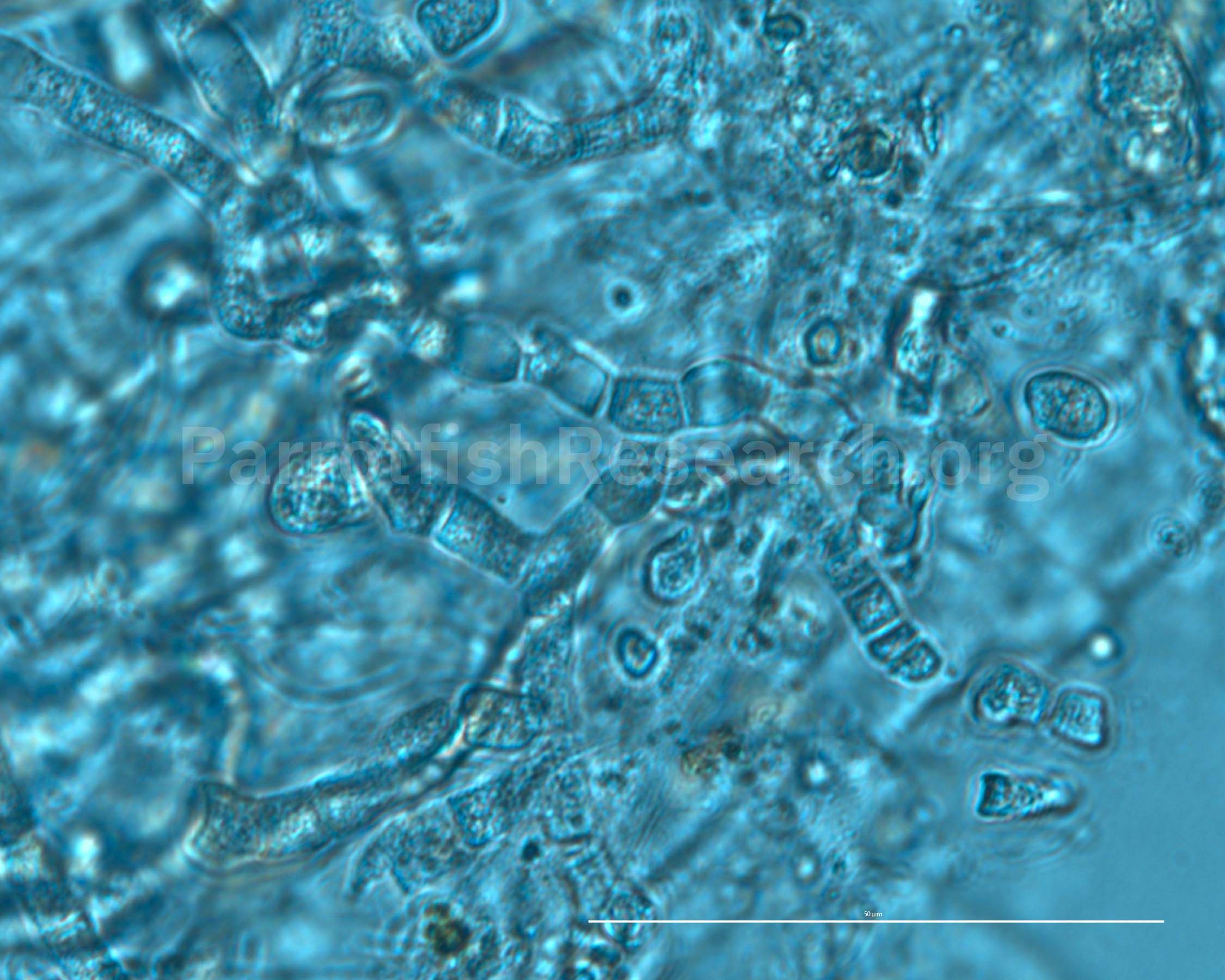 Mastigocoleus Testarum cyanobacteria under a microscope